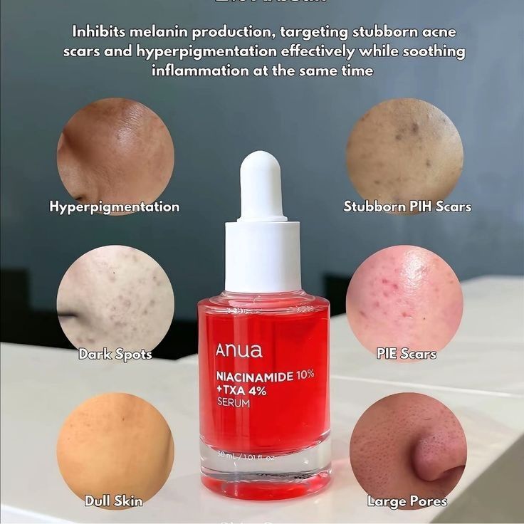 Anua Niacinamide 10% + TXA 4% Dark spot Correcting Serum 30 mL