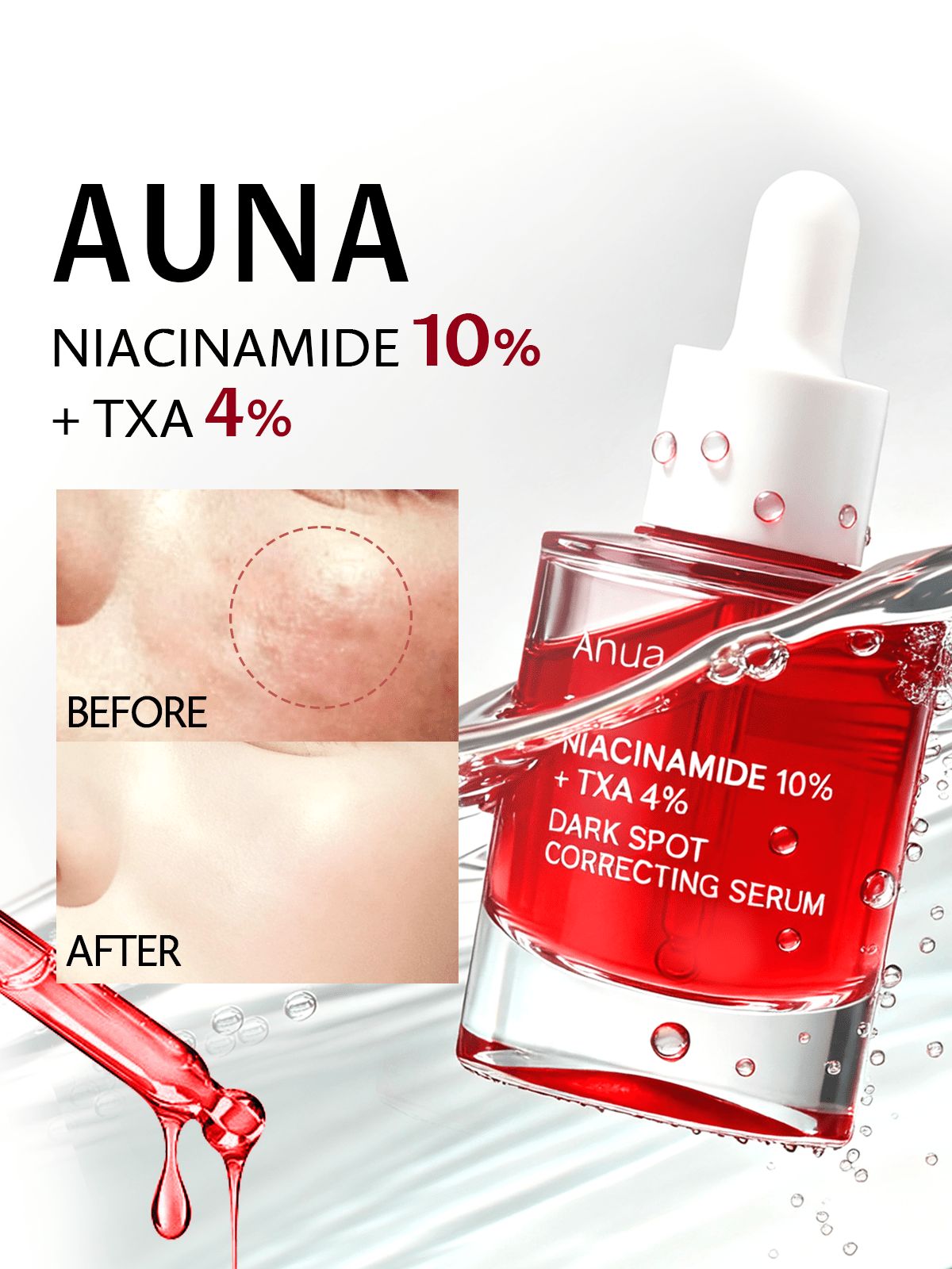 Anua Niacinamide 10% + TXA 4% Dark spot Correcting Serum 30 mL