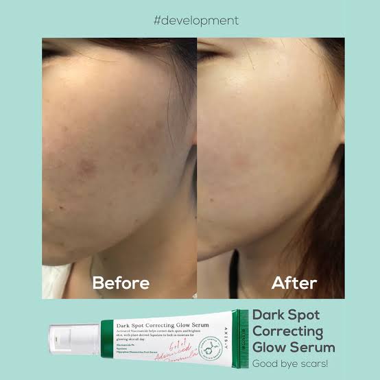 Axis Y Dark Spot Correcting Glow Serum 50 ml